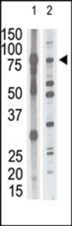 Invitrogen MMP15 Polyclonal Antibody 400 &mu;L | Buy Online | Invitrogen&trade; | Fisher Scientific
