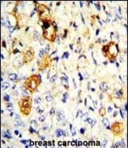 Invitrogen MMP19 Polyclonal Antibody 400 &mu;L; Unconjugated:Antibodies,