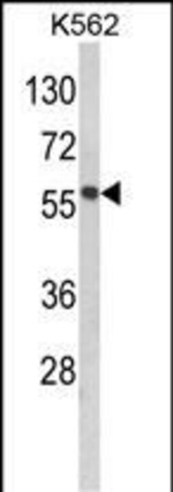 Invitrogen MMP19 Polyclonal Antibody 400 &mu;L; Unconjugated:Antibodies,