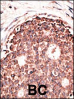 Invitrogen MMP9 Polyclonal Antibody 400 &mu;L | Buy Online | Invitrogen&trade; | Fisher Scientific