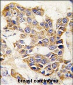 Invitrogen MMP9 Polyclonal Antibody 400 &mu;L | Buy Online | Invitrogen&trade; | Fisher Scientific
