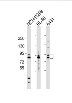 Invitrogen MMP9 Polyclonal Antibody 400 &mu;L | Buy Online | Invitrogen&trade; | Fisher Scientific