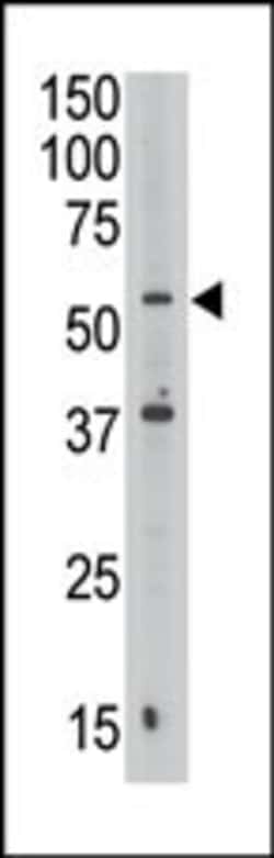 Invitrogen Septin-9 Polyclonal Antibody 400 &mu;L; Unconjugated:Antibodies,