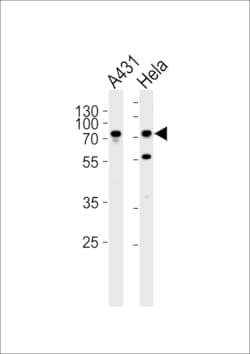 Invitrogen Septin-9 Polyclonal Antibody 400 &mu;L; Unconjugated:Antibodies,