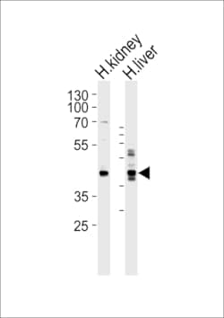 Invitrogen Septin-9 Polyclonal Antibody 400 &mu;L; Unconjugated:Antibodies,