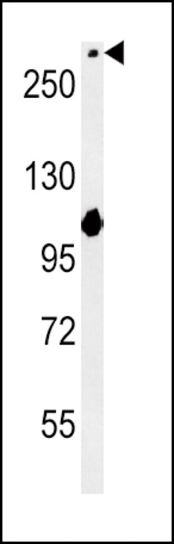 Invitrogen NOTCH3 Polyclonal Antibody 400 &mu;L; Unconjugated:Anticuerpos