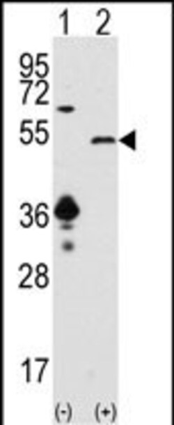 Invitrogen SIRT7 Polyclonal Antibody 400 &mu;L | Buy Online | Invitrogen&trade; | Fisher Scientific