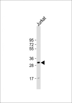 Invitrogen CD82 Polyclonal Antibody 400 μL; Unconjugated:Antibodies,