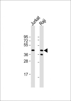 Invitrogen CD82 Polyclonal Antibody 400 μL; Unconjugated:Antibodies,