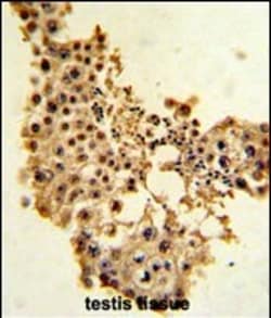 Cyclin E Polyclonal Antibody:Antibodies, Polyclonal