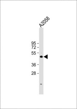 Cyclin E Polyclonal Antibody:Antibodies, Polyclonal