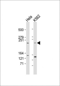 Invitrogen mTOR Polyclonal Antibody 400 &mu;L | Buy Online | Invitrogen&trade; | Fisher Scientific