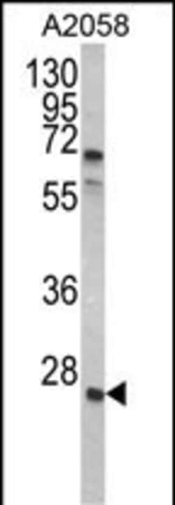 Invitrogen GRB2 Polyclonal Antibody 400 &mu;L; Unconjugated:Antibodies,