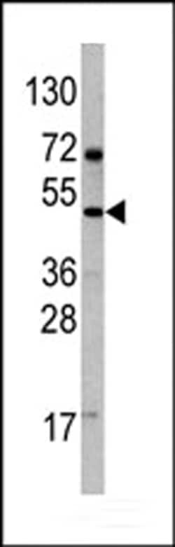 Invitrogen VEGFD Polyclonal Antibody 400 &mu;L | Buy Online | Invitrogen&trade; | Fisher Scientific