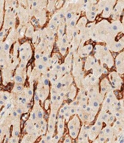 Invitrogen CD14 Polyclonal Antibody 400 &mu;L; Unconjugated:Antibodies,