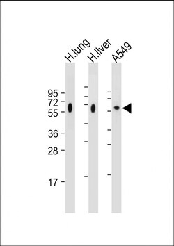 Invitrogen CD14 Polyclonal Antibody 400 &mu;L; Unconjugated:Antibodies,