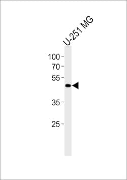 Invitrogen YBX1 Polyclonal Antibody 400 &mu;L | Buy Online | Invitrogen&trade; | Fisher Scientific