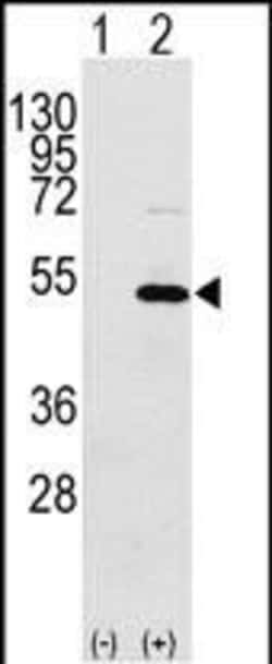 Invitrogen YBX1 Polyclonal Antibody 400 &mu;L | Buy Online | Invitrogen&trade; | Fisher Scientific