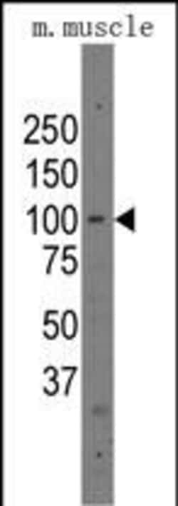 Invitrogen PARP12 Polyclonal Antibody 400 &mu;L; Unconjugated:Antibodies,