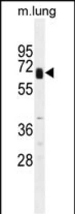 Invitrogen Glypican 3 Polyclonal Antibody 400 &mu;L; Unconjugated:Antibodies,