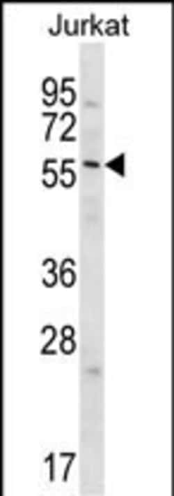 Invitrogen Glypican 3 Polyclonal Antibody 400 &mu;L; Unconjugated:Antibodies,