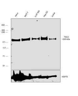 Invitrogen TSC2 Polyclonal Antibody 400 &mu;L | Buy Online | Invitrogen&trade; | Fisher Scientific