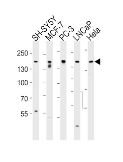 Invitrogen TSC2 Polyclonal Antibody 400 &mu;L | Buy Online | Invitrogen&trade; | Fisher Scientific