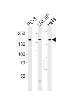 Invitrogen TSC2 Polyclonal Antibody 400 &mu;L | Buy Online | Invitrogen&trade; | Fisher Scientific