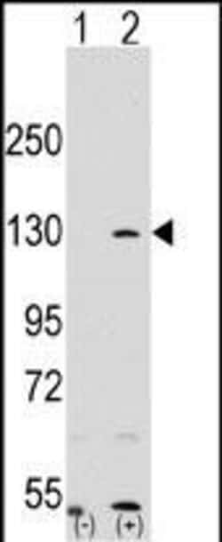 Invitrogen PARP1 Polyclonal Antibody 400 &mu;L | Buy Online | Invitrogen&trade; | Fisher Scientific