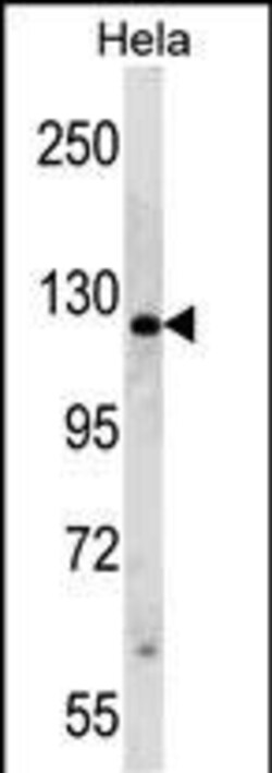 Invitrogen PARP1 Polyclonal Antibody 400 &mu;L | Buy Online | Invitrogen&trade; | Fisher Scientific