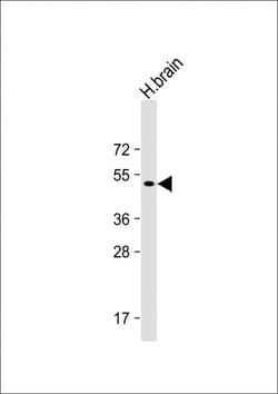 Invitrogen Parkin Polyclonal Antibody 400 &mu;L; Unconjugated:Antibodies,