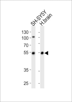 Invitrogen Parkin Polyclonal Antibody 400 &mu;L; Unconjugated:Antibodies,