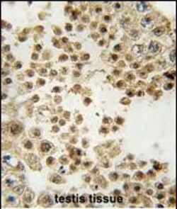 Invitrogen Parkin Polyclonal Antibody 400 &mu;L | Buy Online | Invitrogen&trade; | Fisher Scientific