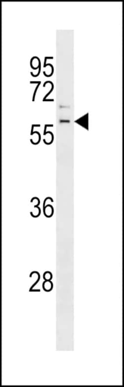 Invitrogen Parkin Polyclonal Antibody 400 &mu;L | Buy Online | Invitrogen&trade; | Fisher Scientific