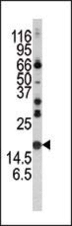 Invitrogen alpha Synuclein Polyclonal Antibody 400 &mu;L; Unconjugated:Antibodies,
