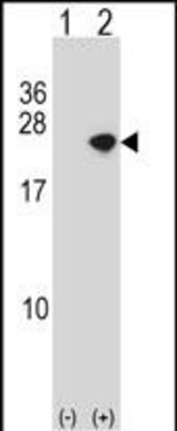 Invitrogen alpha Synuclein Polyclonal Antibody 400 &mu;L; Unconjugated:Antibodies,