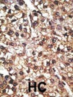Invitrogen PINK1 Polyclonal Antibody 400 &mu;L; Unconjugated:Antibodies,