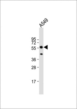 Invitrogen PINK1 Polyclonal Antibody 400 &mu;L; Unconjugated:Antibodies,