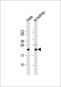 Invitrogen DJ-1 Polyclonal Antibody 400 &mu;L; Unconjugated:Antibodies,