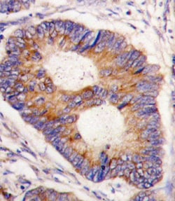 Invitrogen FXN Polyclonal Antibody 400 &mu;L; Unconjugated:Antibodies,