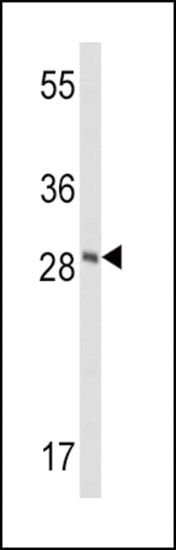 Invitrogen FXN Polyclonal Antibody 400 &mu;L; Unconjugated:Antibodies,
