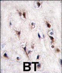 Invitrogen Nurr1 Polyclonal Antibody 400 &mu;L; Unconjugated:Antibodies,