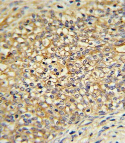 Invitrogen UGT2B17 Polyclonal Antibody 400 &mu;L; Unconjugated:Antibodies,