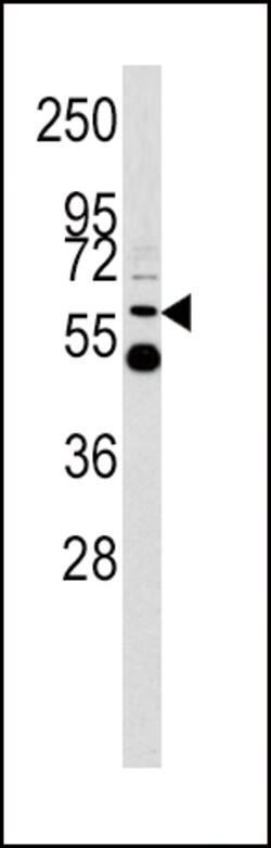 Invitrogen UGT2B17 Polyclonal Antibody 400 &mu;L; Unconjugated:Antibodies,