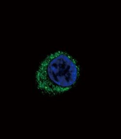 Invitrogen Endothelin A Receptor Polyclonal Antibody 400 &mu;L; Unconjugated:Antibodies,