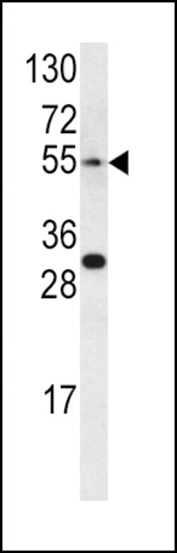 Invitrogen Endothelin A Receptor Polyclonal Antibody 400 &mu;L; Unconjugated:Antibodies,