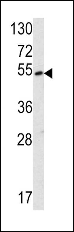 Invitrogen SUV420H2 Polyclonal Antibody 200 &mu;L; Unconjugated:Antibodies,