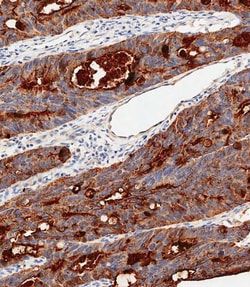 Invitrogen CEA Polyclonal Antibody 400 &mu;L; Unconjugated:Antibodies,