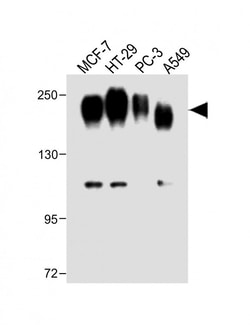 Invitrogen CEA Polyclonal Antibody 400 &mu;L; Unconjugated:Antibodies,