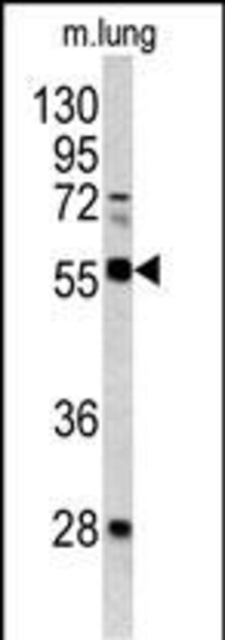 Invitrogen FLI1 Polyclonal Antibody 400 &mu;L; Unconjugated:Anticuerpos
